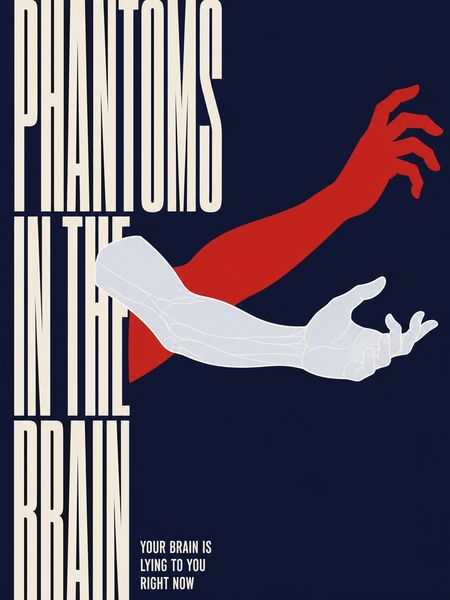 Phantoms in the Brain
